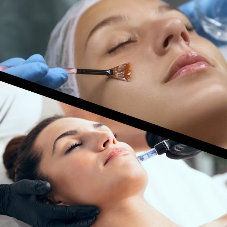 Indian Head Massage Wolverhampton